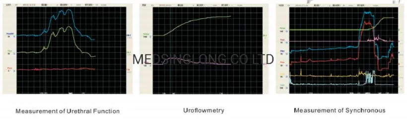 Urodynamic Curves Detail