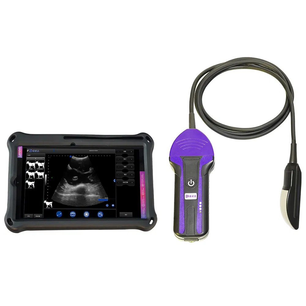 Bxl-S104 Wireless Portable Ultrasound Machine System for Sale with HD Image General Probe