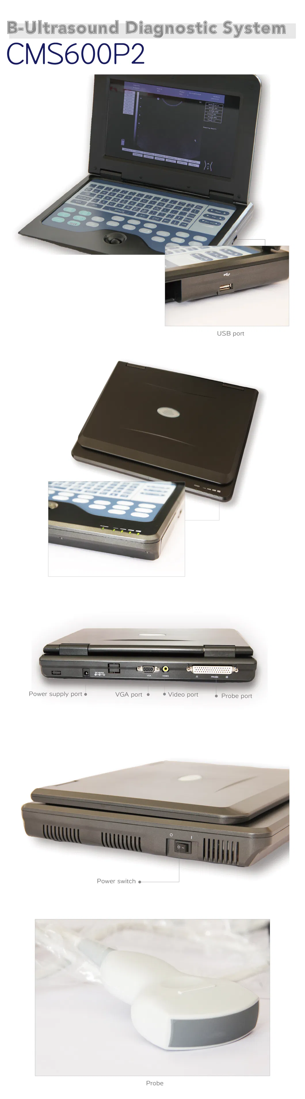 Notebook Diagnostic Ultrasound System