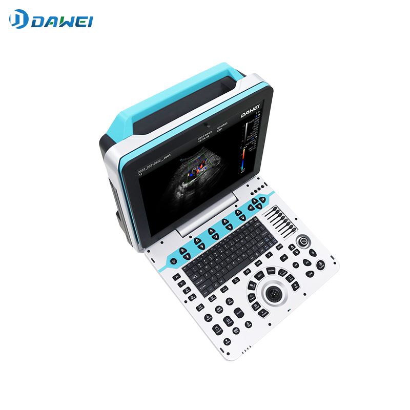 Dw-P50 Portable Ultrasound Empowers Precision Diagnostic Imaging for Gynaecology Obstetrics