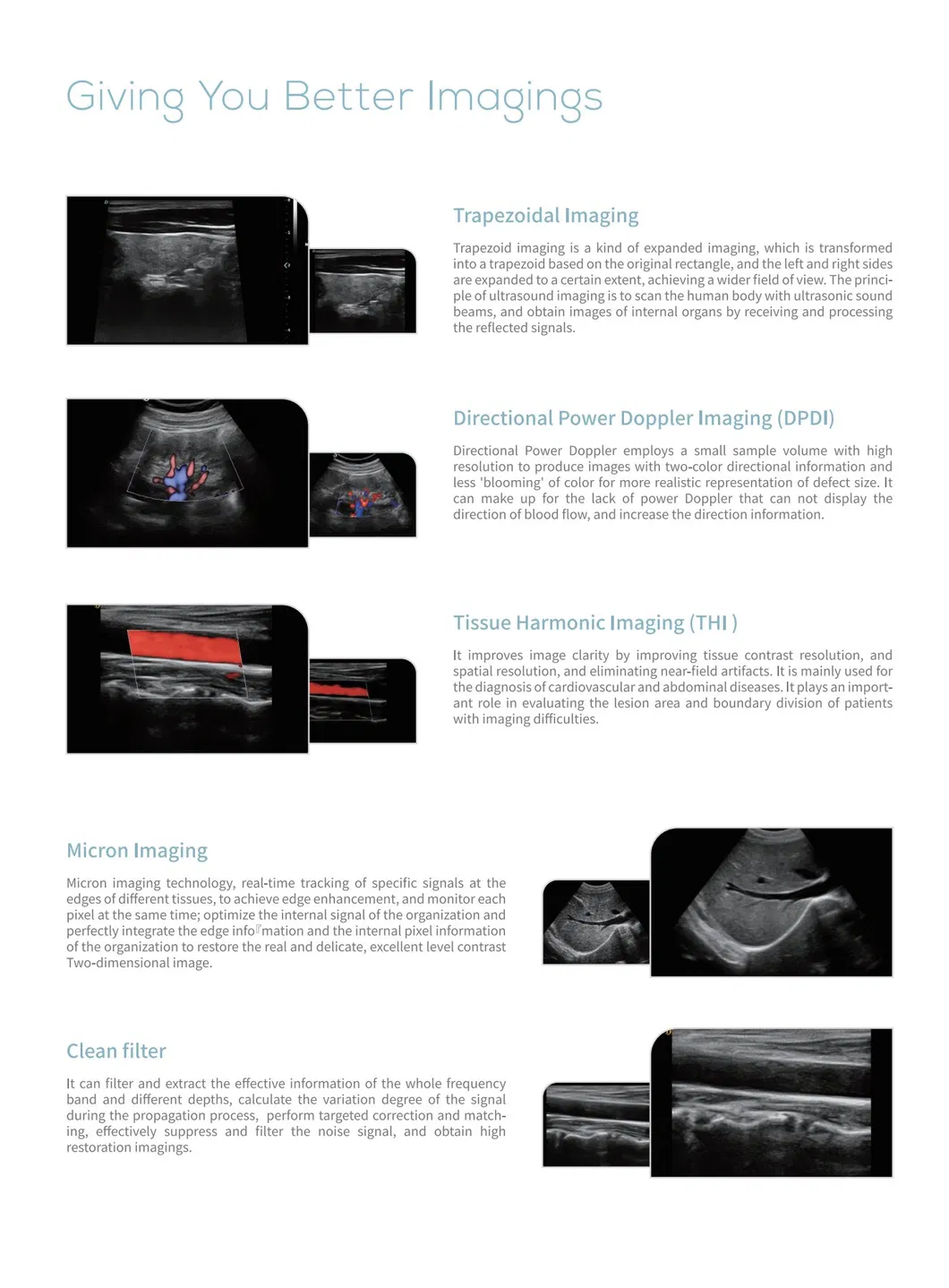 Ultrasound View 2