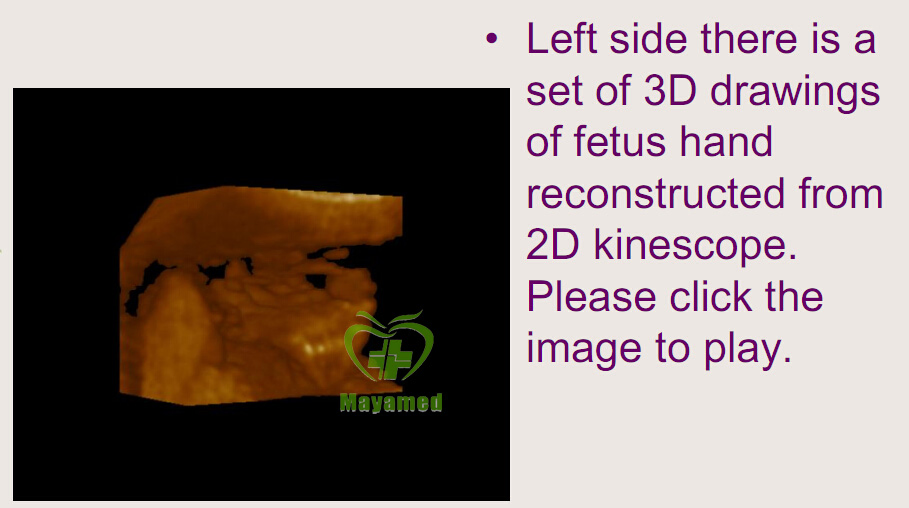 My-A020A Hospital Equipment Full Digital Ultrasonic Diagnostic Equipment