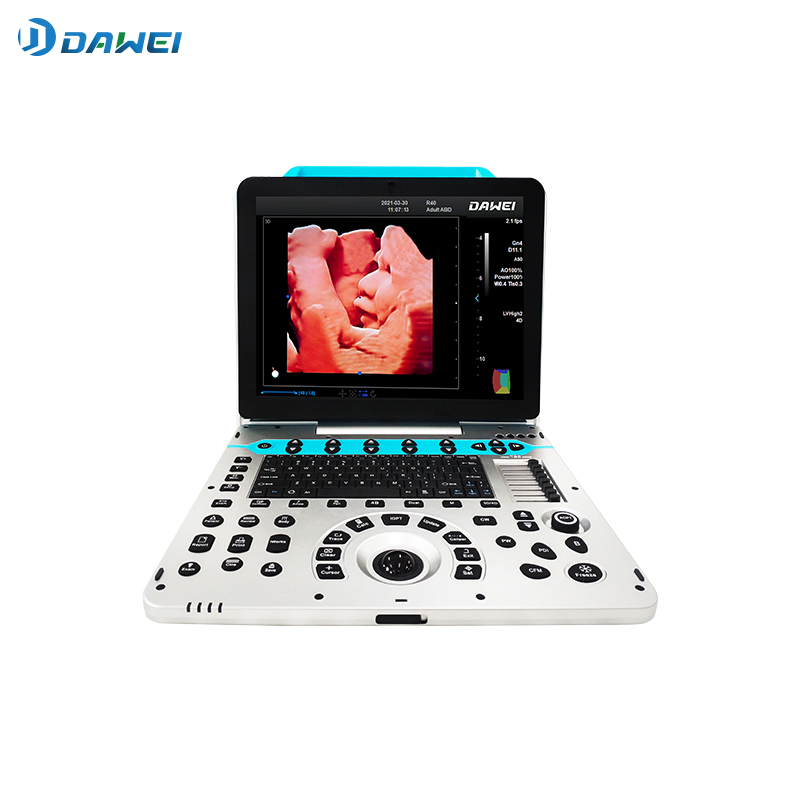 Dw-P50 Portable Ultrasound Empowers Precision Diagnostic Imaging for Gynaecology Obstetrics
