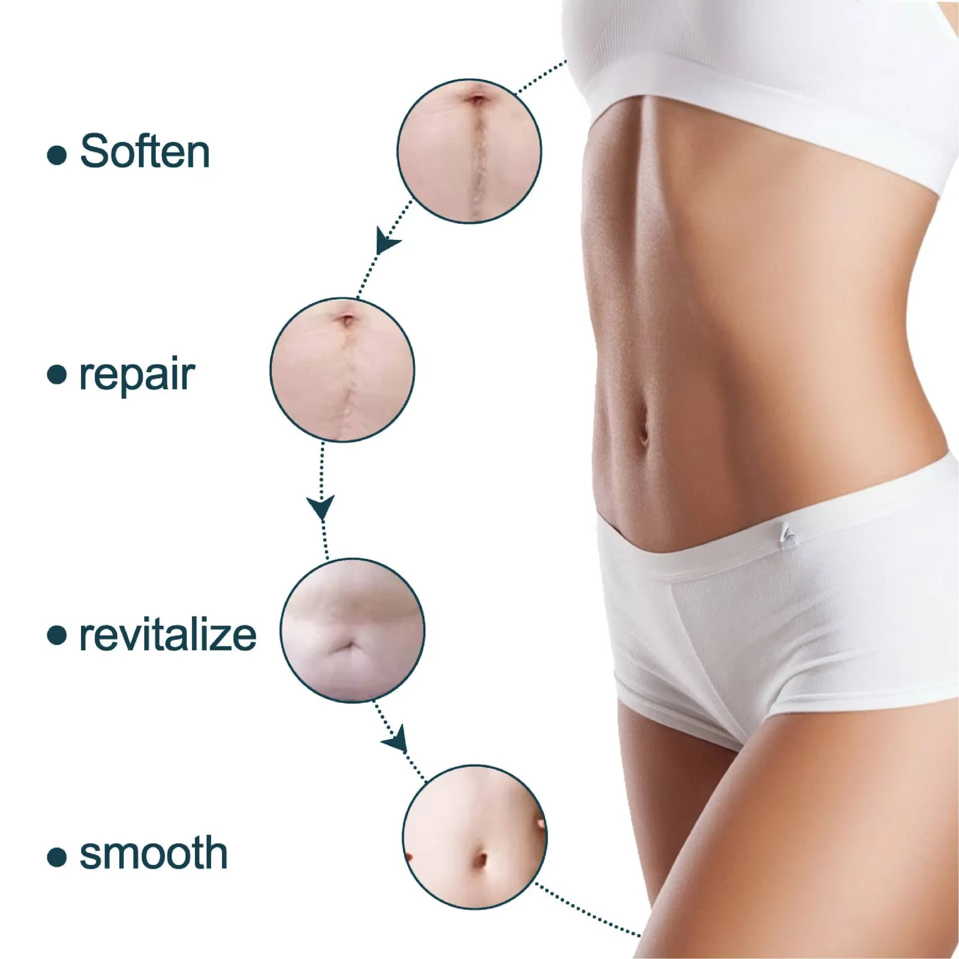 Scar Revision Patch Application 7