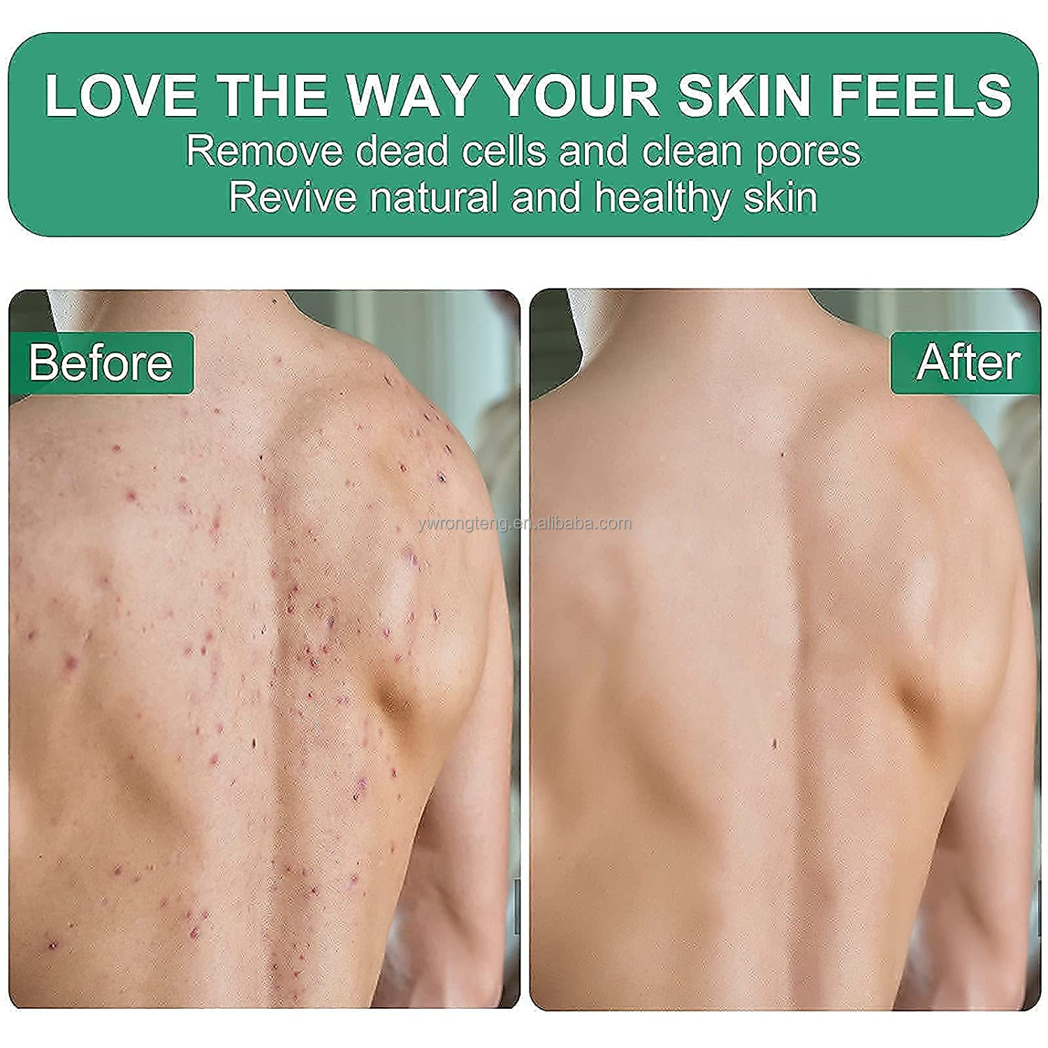 Exfoliating Mitt 2