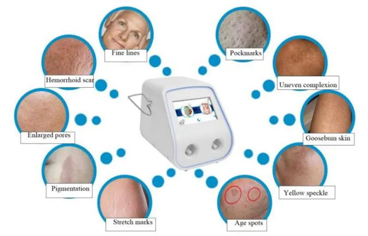 RF Fractional Scar Removal Machine Treatment Area