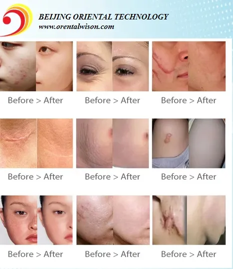 Before and After 2