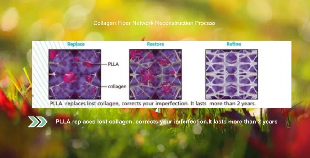 Reborn Plla Detail 2