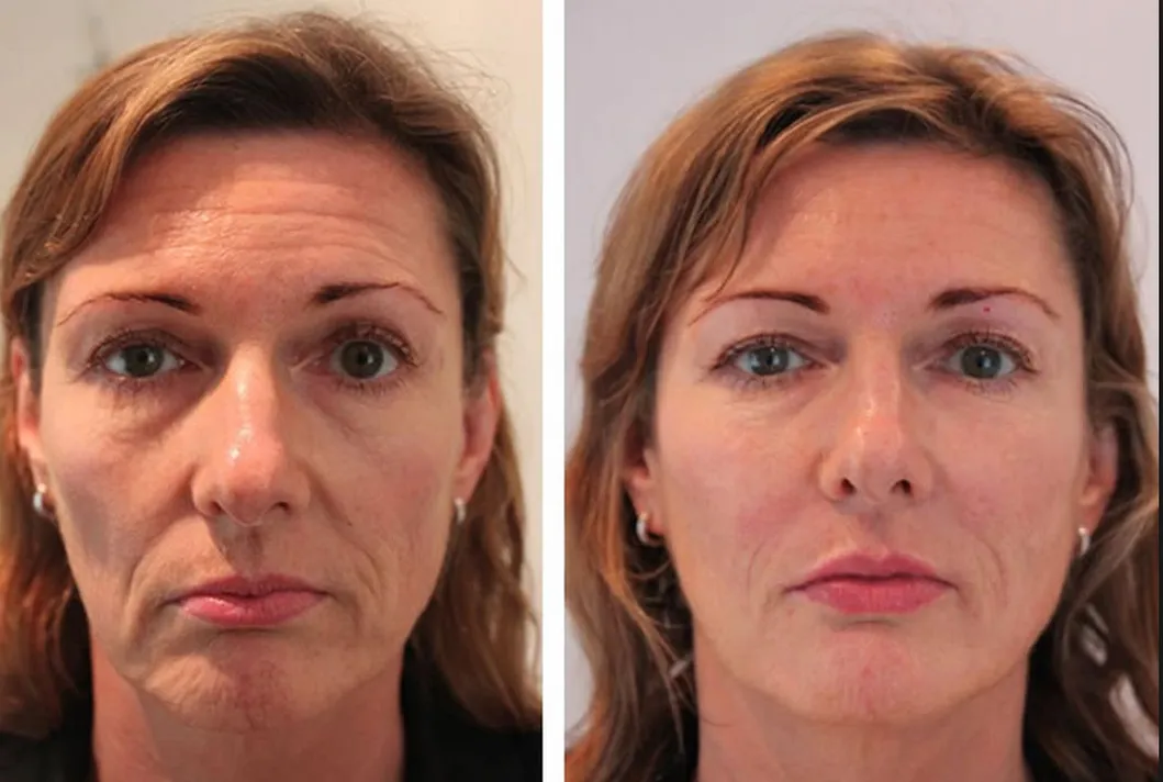 Before and After 3
