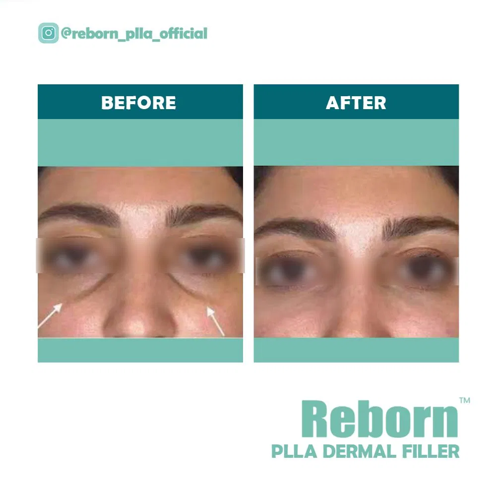 Before and After Results