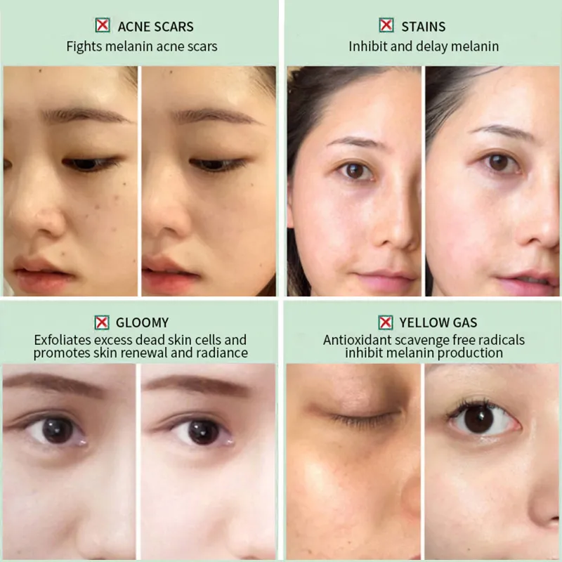 Skin Care Mask