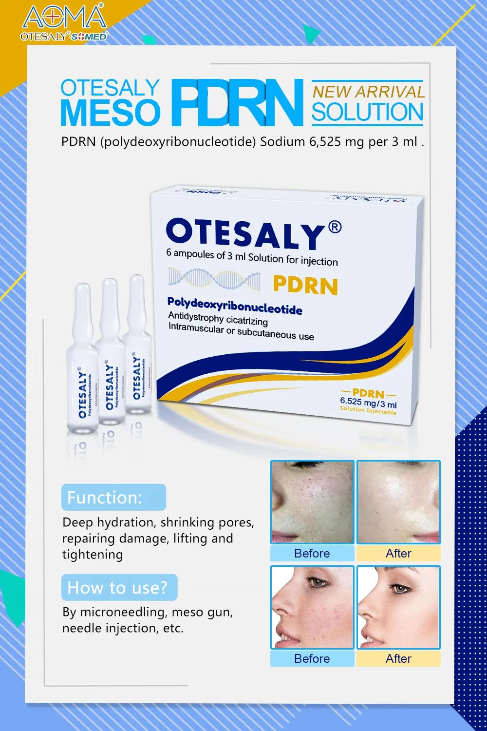 Otesaly Pdrn Solution Injectable Facial Care Skin Whitening Salmon DNA Serum Pdrn Injecction Placentex
