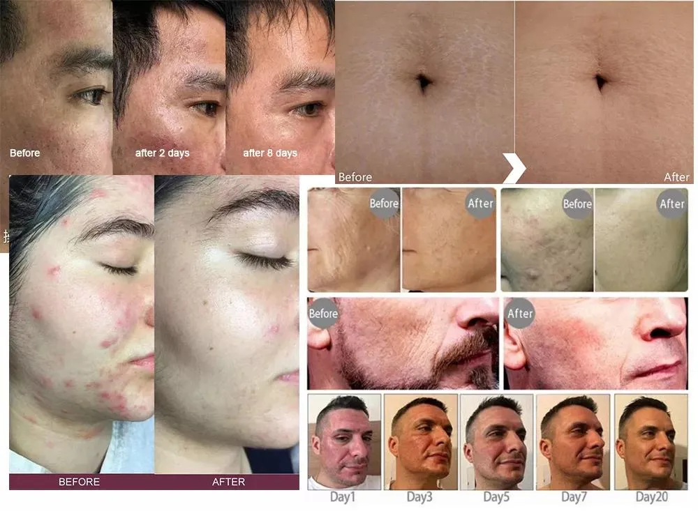 Before and After Treatment Results