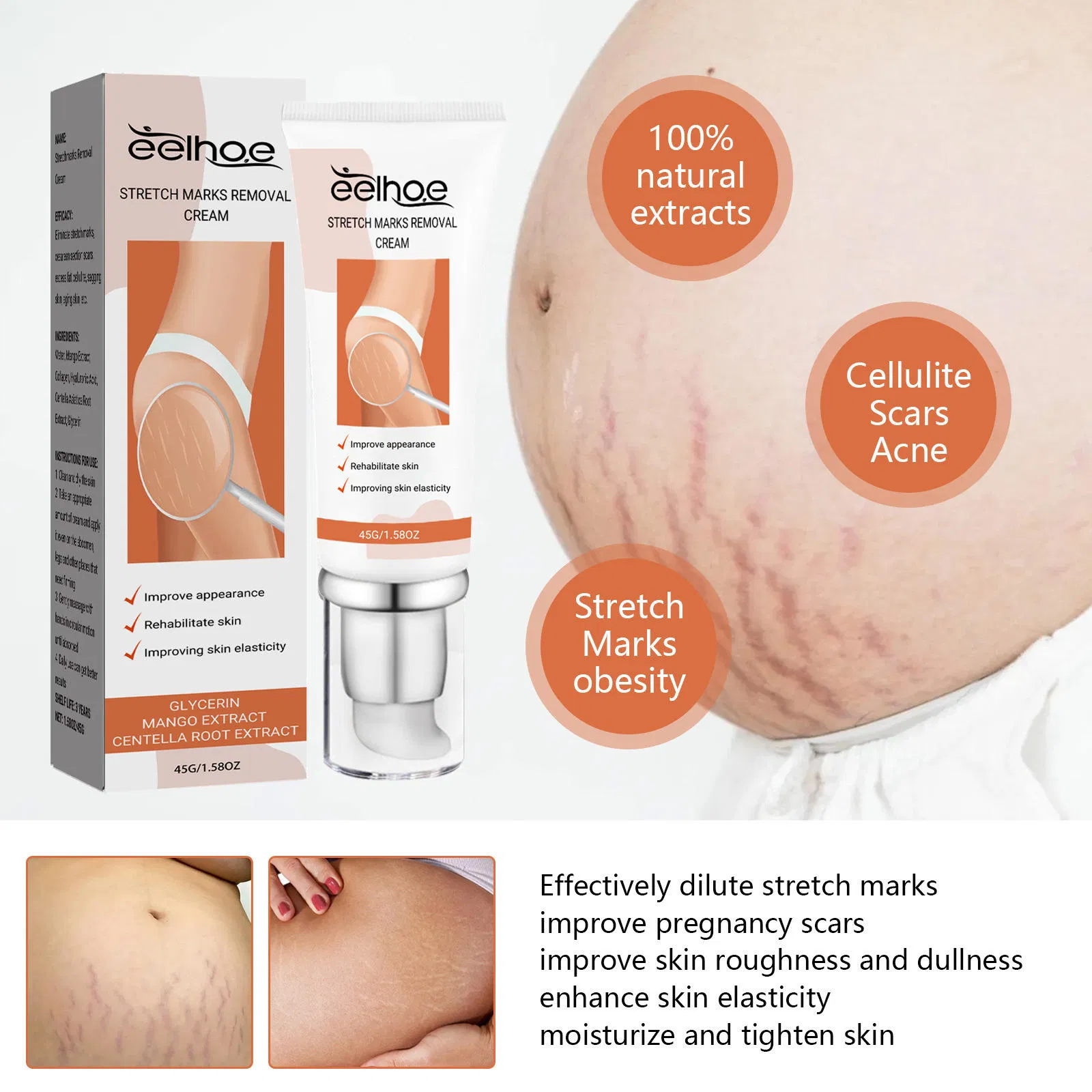 Shea Butter Scar Removal Lotion for Body Skin Stretch Marks Fades and Smooths Stretch Mark Cream for Pregnancy Care