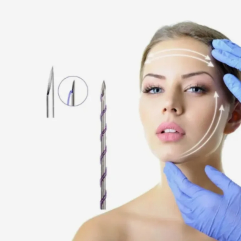 High-Quality Hskinlift Pdo Fishbone to Tighten and Tighten Skin, Absorbable Facial Skin Lifting Double