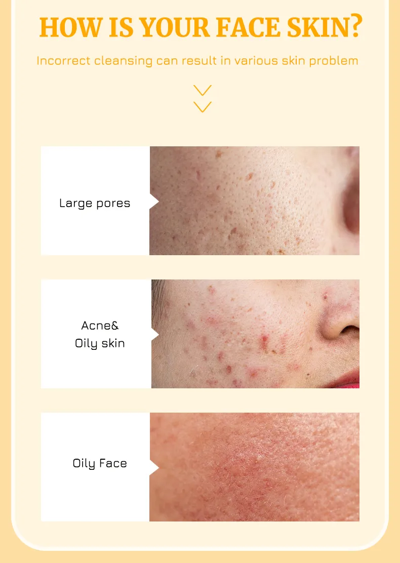 Facial Cleansing Mousse 2