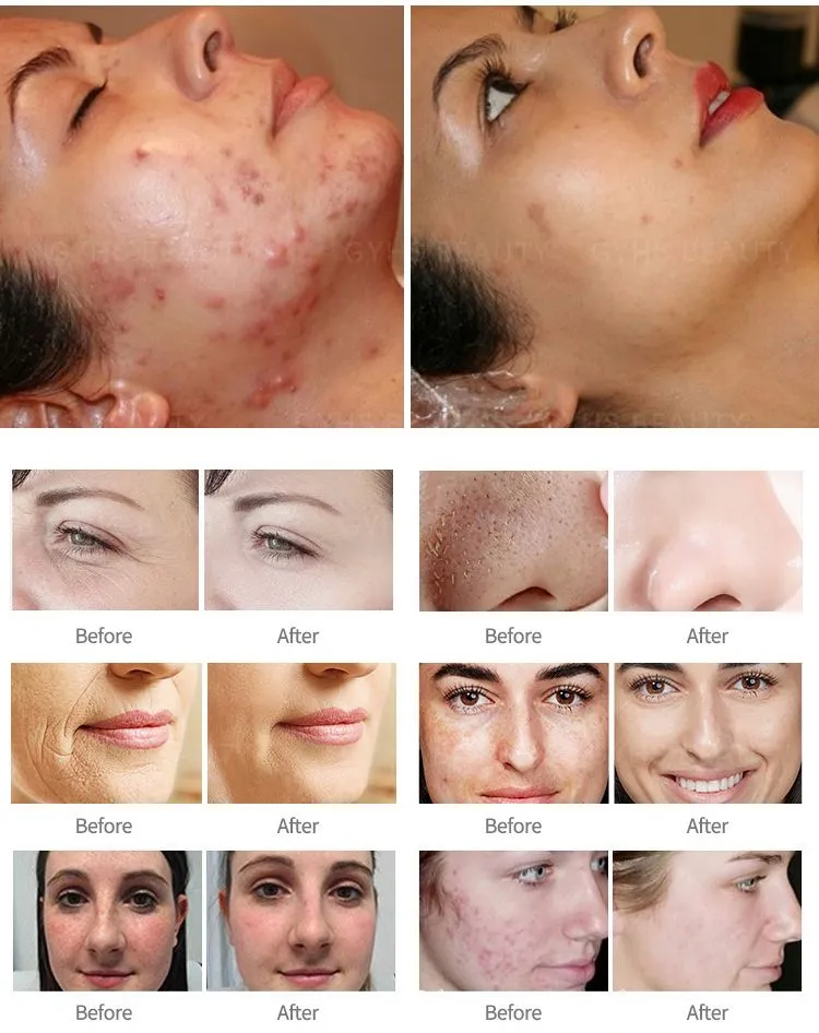 Skin Repair Result