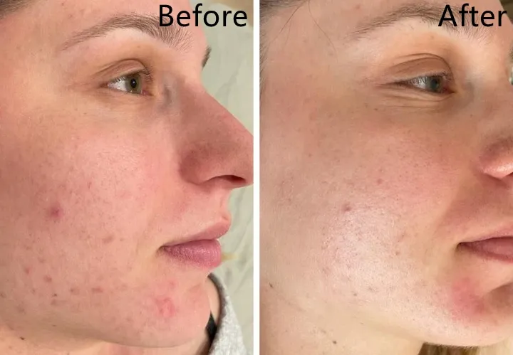 Before and After 1