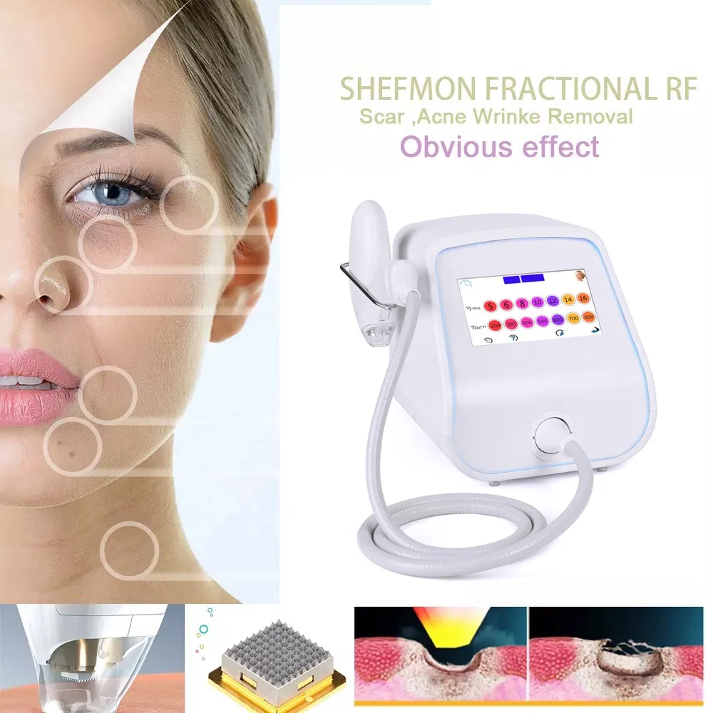 RF Fractional Scar Removal Machine Anti-Age Fractional RF Microneedle Machine Stretch Marks and Scar Removal