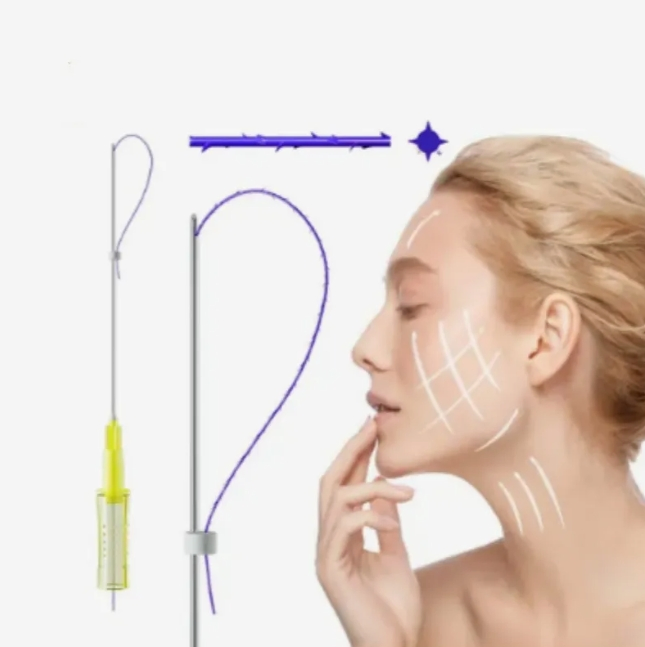 High-Quality Hskinlift Pdo Fishbone to Tighten and Tighten Skin, Absorbable Facial Skin Lifting Double