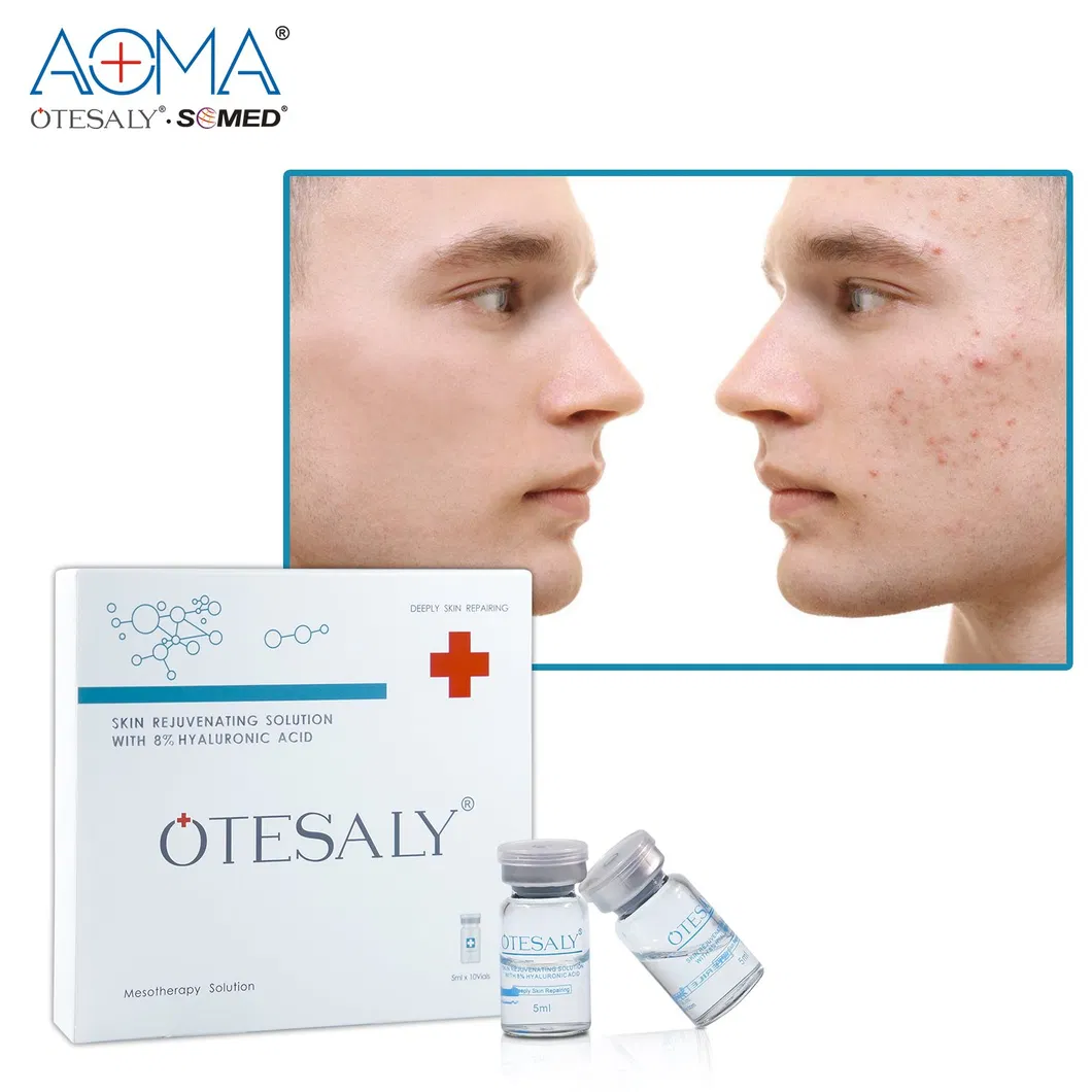 Otesaly Pdrn Solution Injectable Facial Care Skin Whitening Salmon DNA Serum Pdrn Injecction Placentex