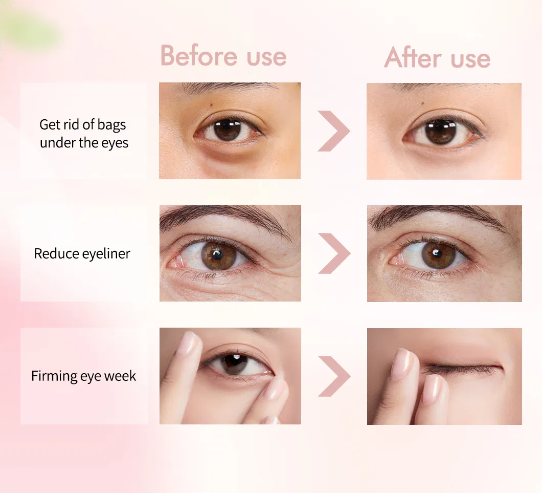 Herbal Flower Moisturizing Eye Treatment