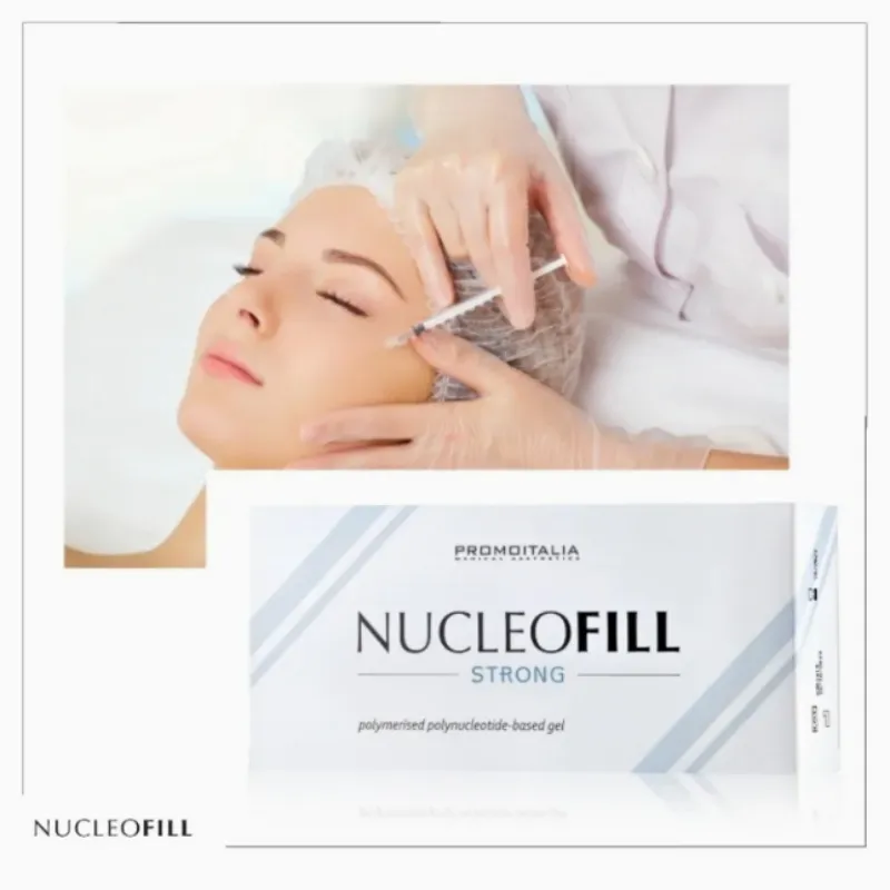 Nucleofill Detail 2