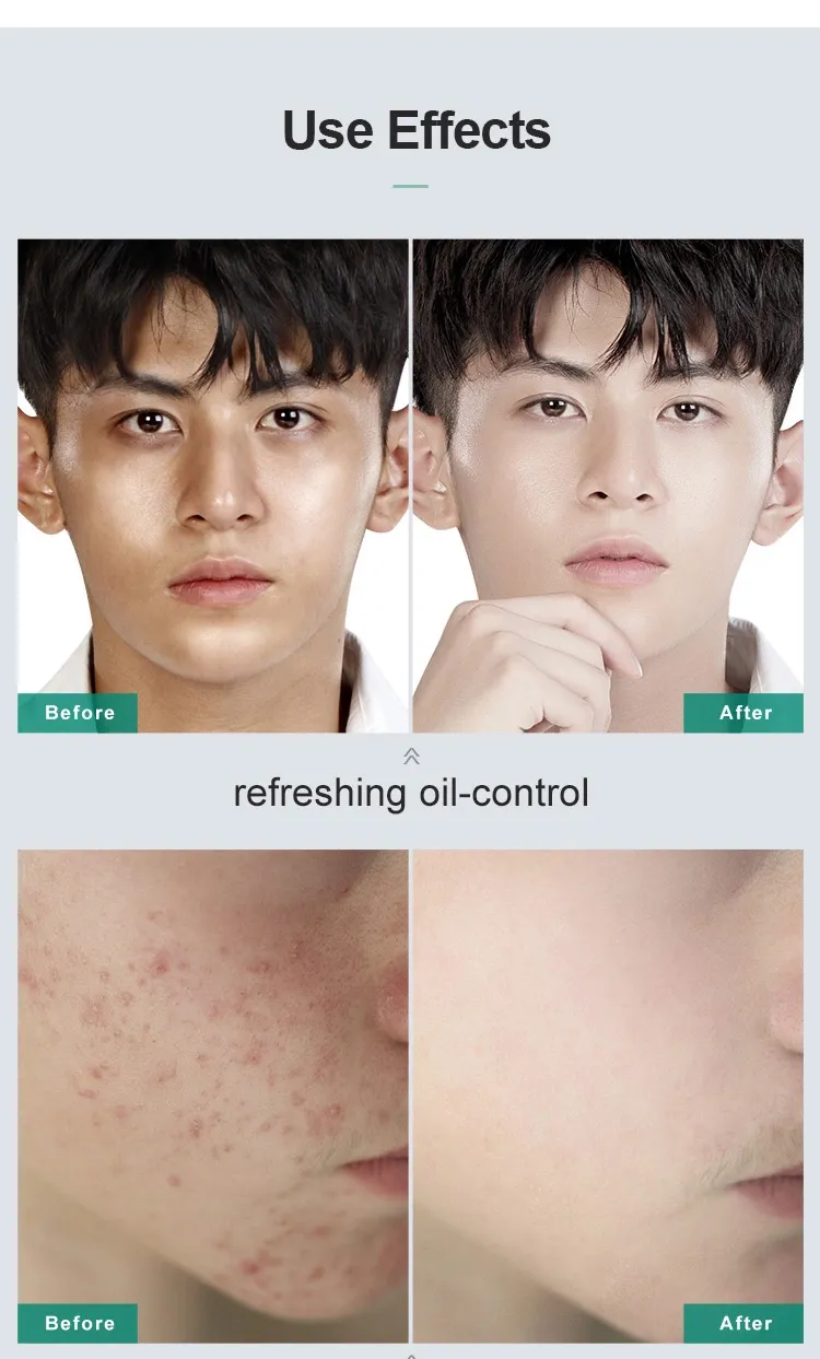 Private Label Men Amino Acid Cleanser Deep Cleansing Oil Control Foam Herbal