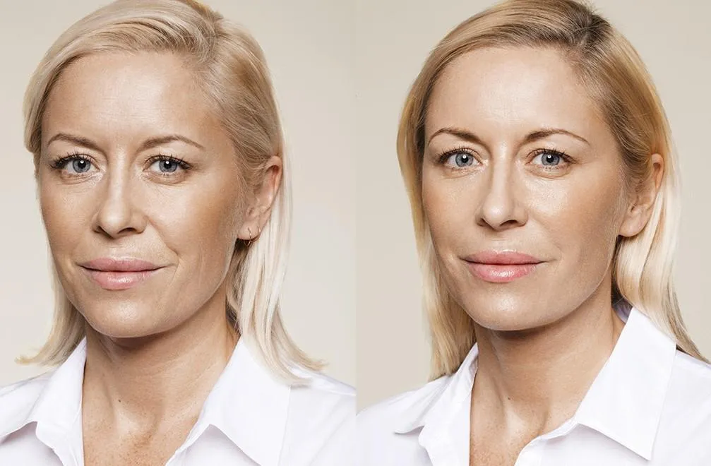 Before and After 2