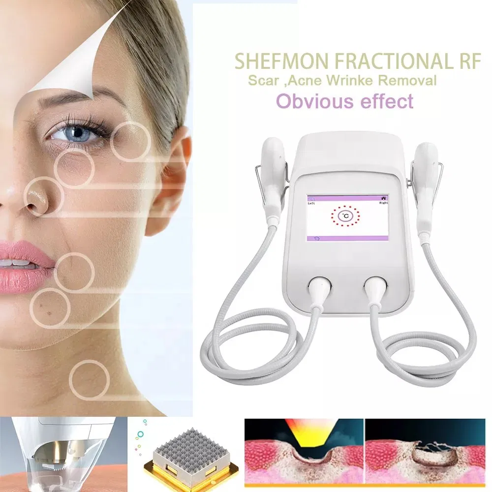 T-Ixel Radio Frequency Microneedling Fractional RF Machine for Scar Remover