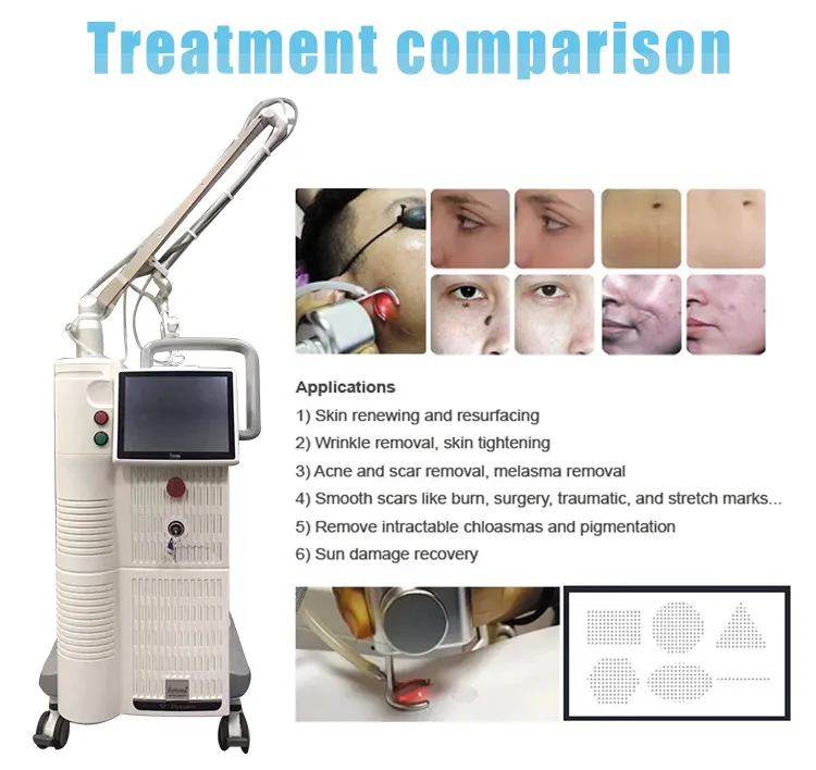 Powerful 60W 10600nm CO2 Fractional Laser Machine Vaginal Tightening and Skin Resurfacing Beauty Care