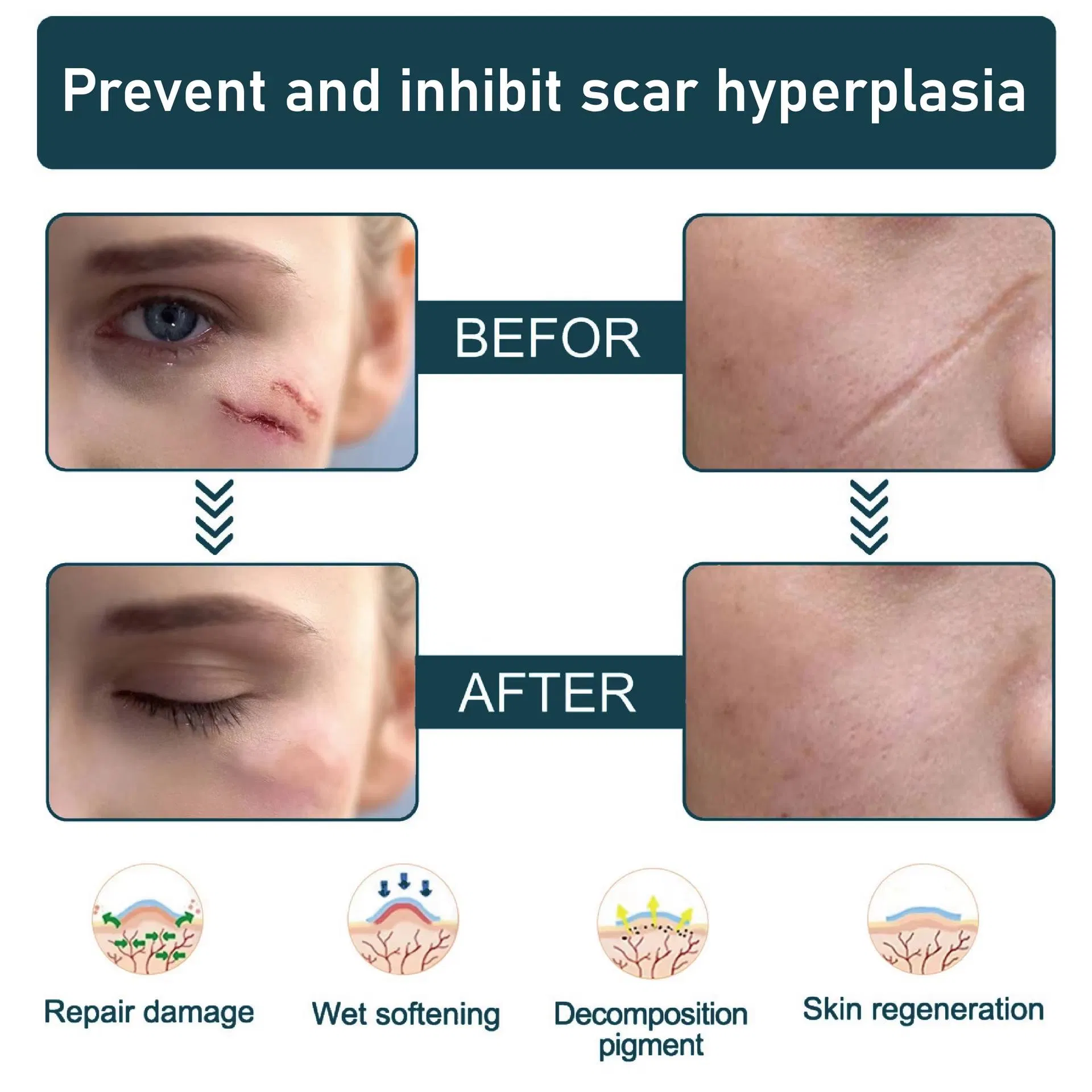 Scar Revision Patch Application 6