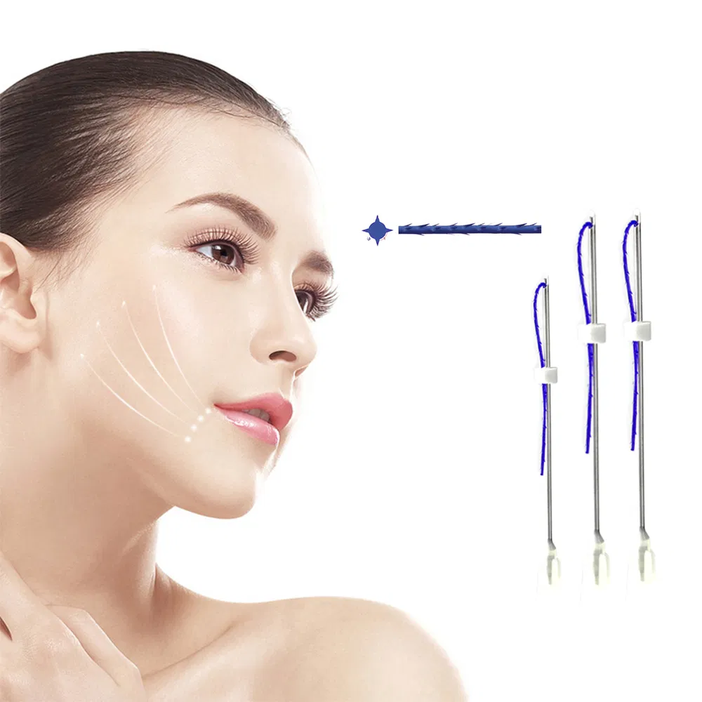 Pdo Beauty Lifting Threads for Jawline Chin Contour Skin Firming and Wrinkle Reduction
