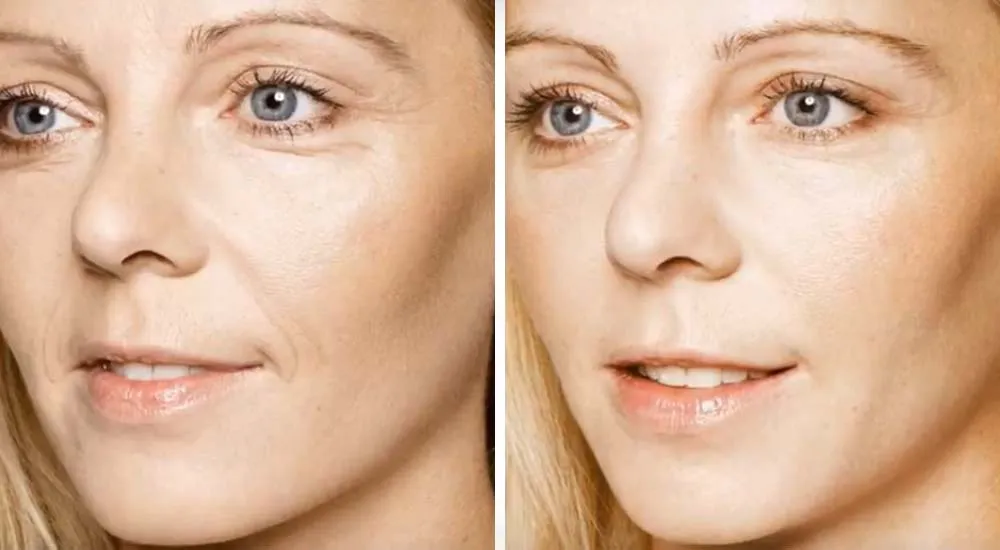 Before and After 4