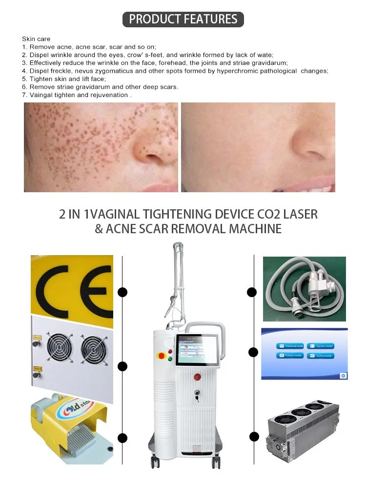 Powerful 60W 10600nm CO2 Fractional Laser Machine Vaginal Tightening and Skin Resurfacing Beauty Care