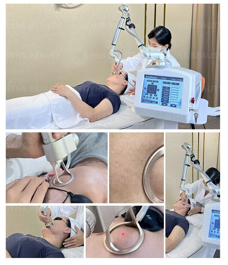 Using Case