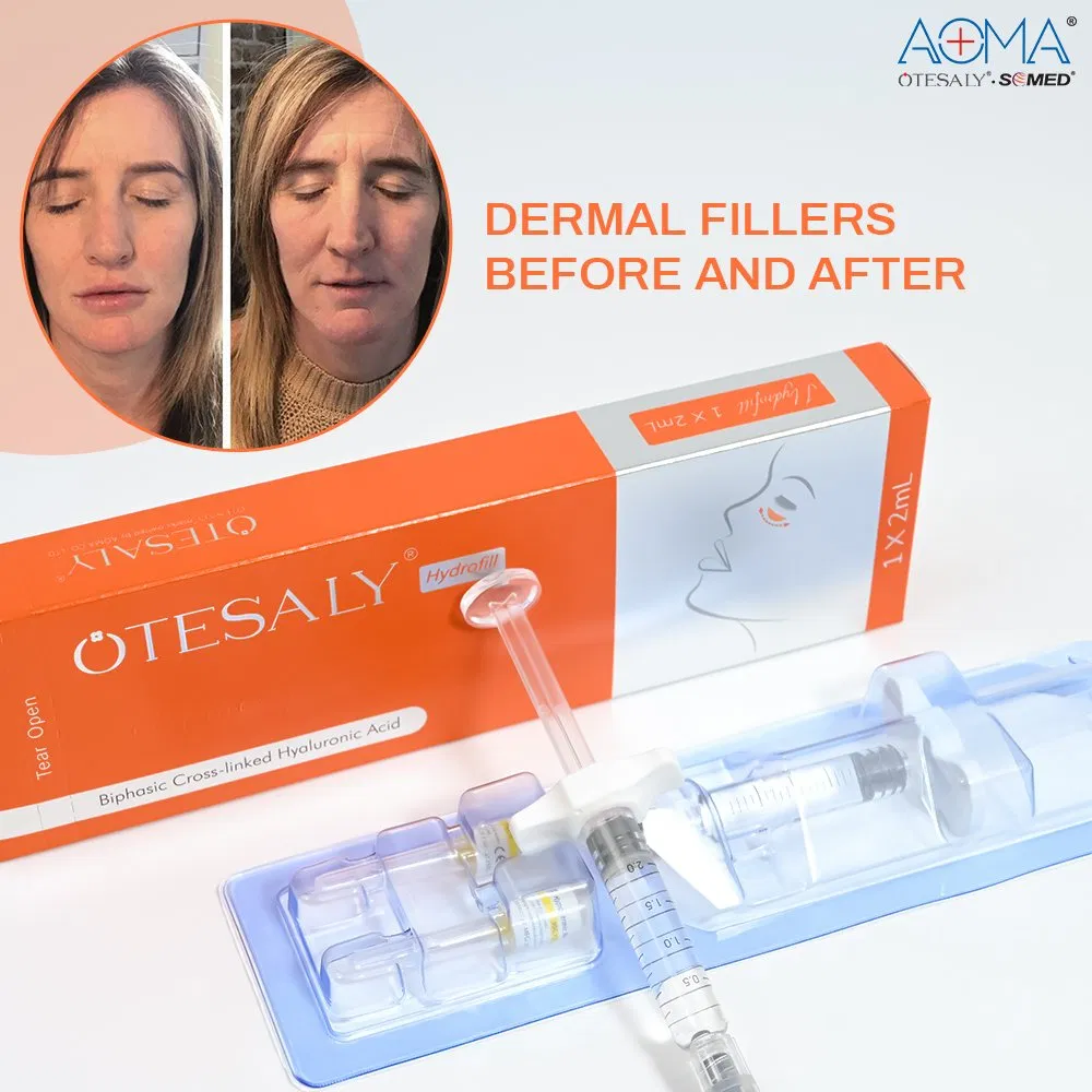 Good Effect Tear Trough Filler Lifting and Firming Otesaly 2ml Vital Lifting Hyaluronic Acid Serum