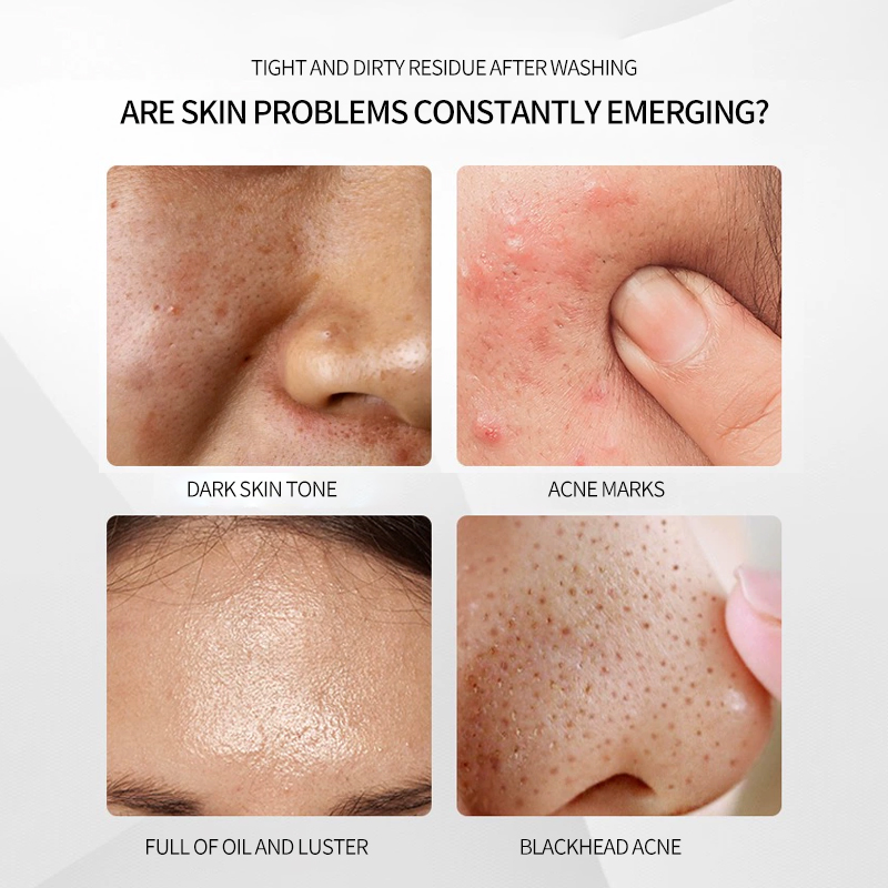 Amino Acid Moisturizing Brightening Deep Cleanser Deep Cleansing Mousse Mild Formula