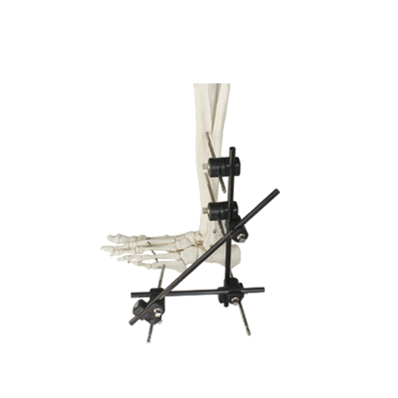 Orthopedic Surgical External Fixation Support Peek Tibial Proximal Nail Target Device