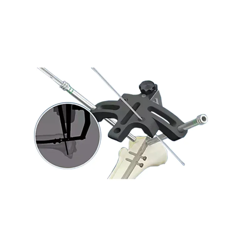 Orthopedic Medical Device Photo 3