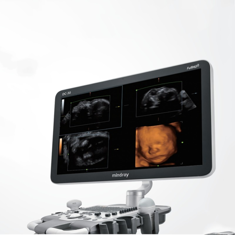 Advanced Fullhd Diagnostic Ultrasound Imaging System for Medical Professionals