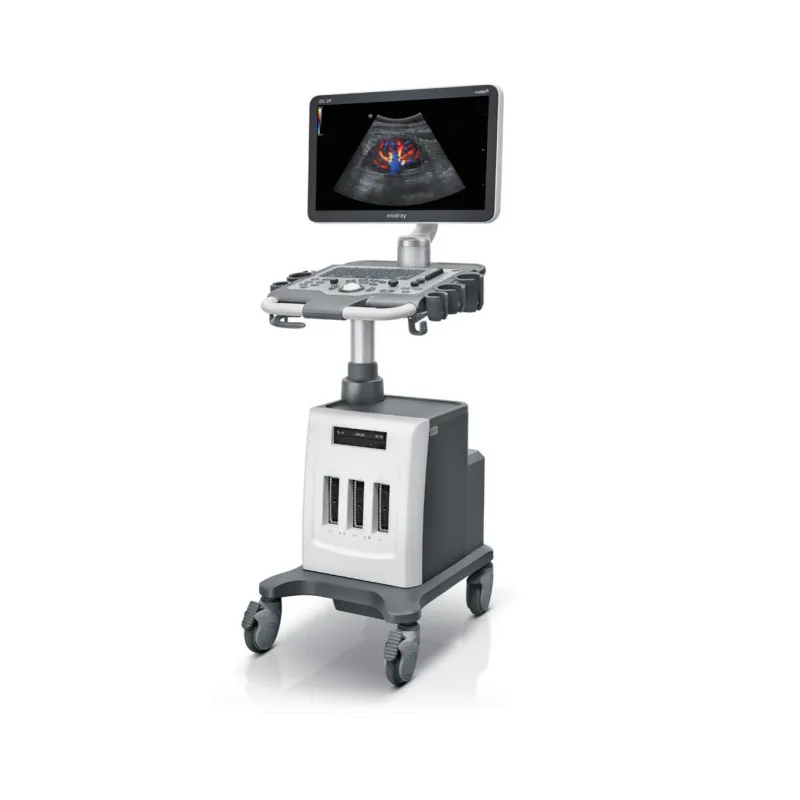 Ultrasound System View 1