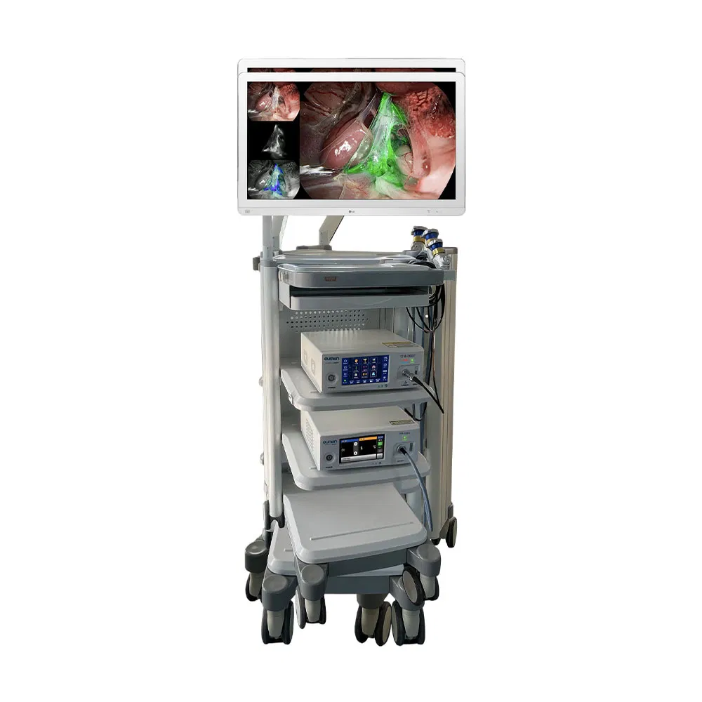 Endoscopy System Detail 3