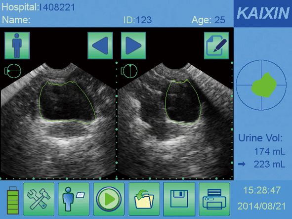 Reliable Kaixin Bvt07 Bladder Scanner for Special Care and Home Health Solutions