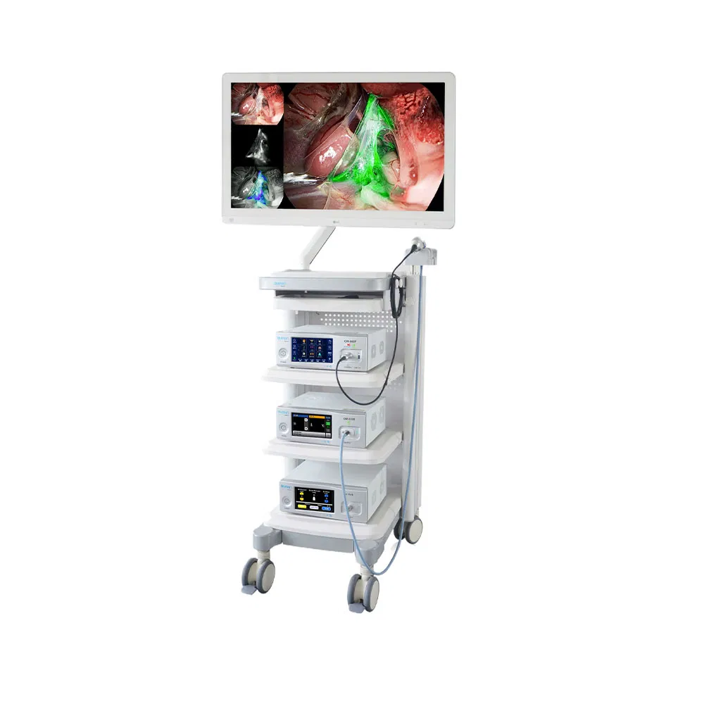 Ergonomic Layout Mobile Surgical Endoscopy Tower System