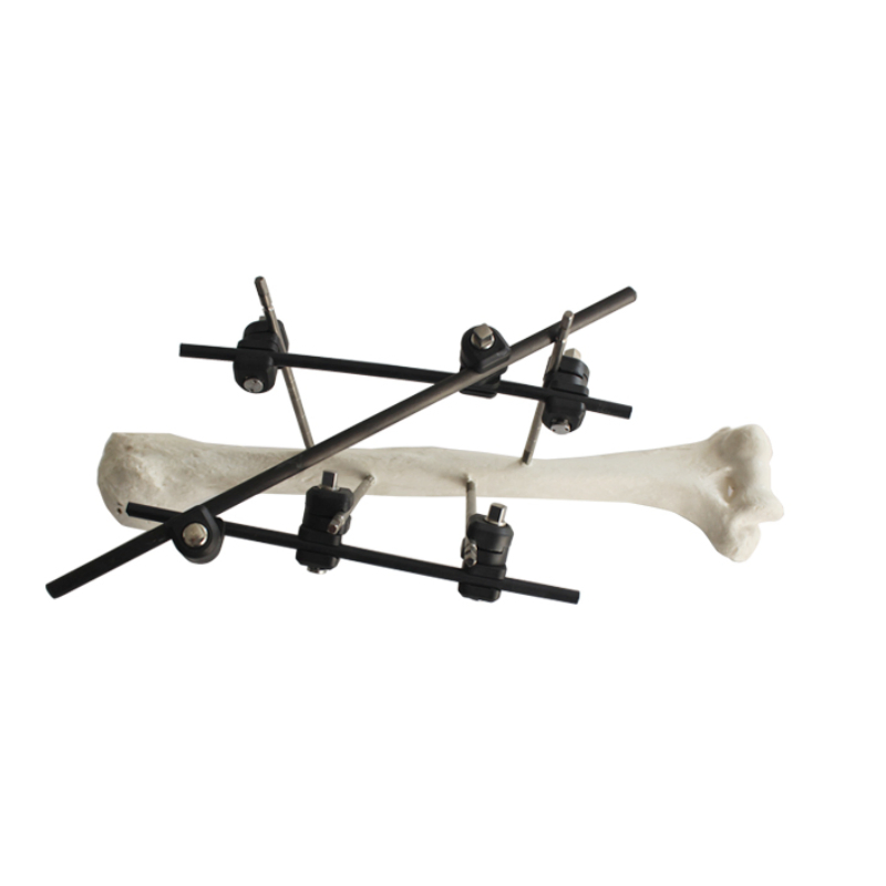 Orthopedic Surgical External Fixation Support Peek Tibial Proximal Nail Target Device