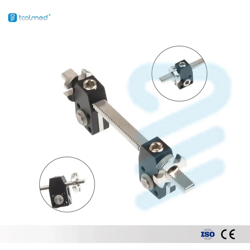 External Fixation Feature