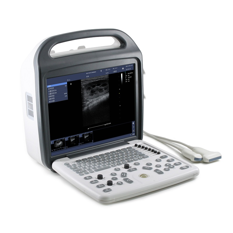 Umus002 Vet Ultrasound System--Portable, 320mm Depth, Dicom 3.0, 500GB Storage