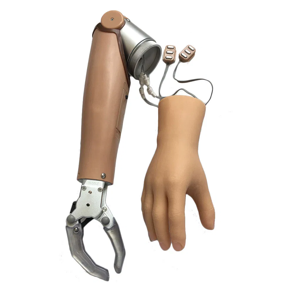 Myoelectric Prosthesis Physical Therapy Equipment Hand 2
