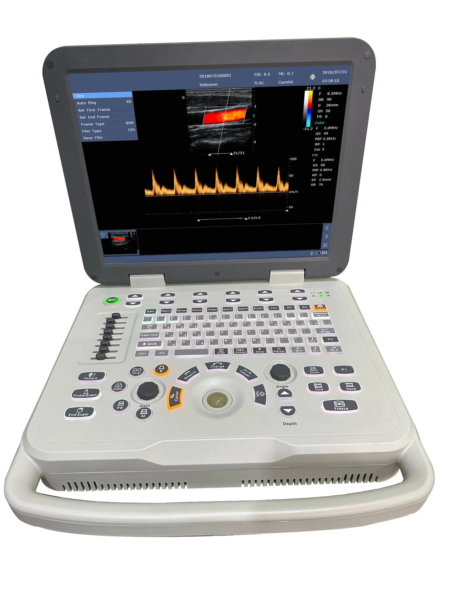Advanced Veterinary Color Ultrasound System for Animal Health Monitoring